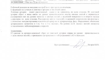 Лечение ангиодисплазии