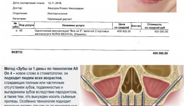 Собираю на срочную операцию по имплантации зубов