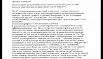 2 стадия рака кісток, є надія!