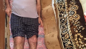 На лечение отца от рака