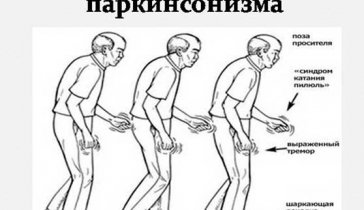 Сбор на лечение