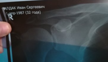 Заболел раком