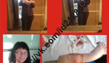 Друзья,необходимы деньги на лекарство. обезболивающие и антибиотики...