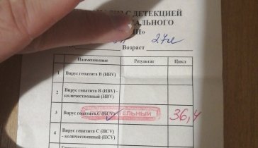 Гепатит С