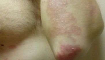 Помощь в заболевании