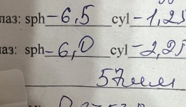 Операция на глаза